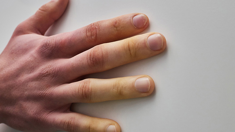 Mô liên kết là gì? Vì sao khi vực này dễ bị quá tải?